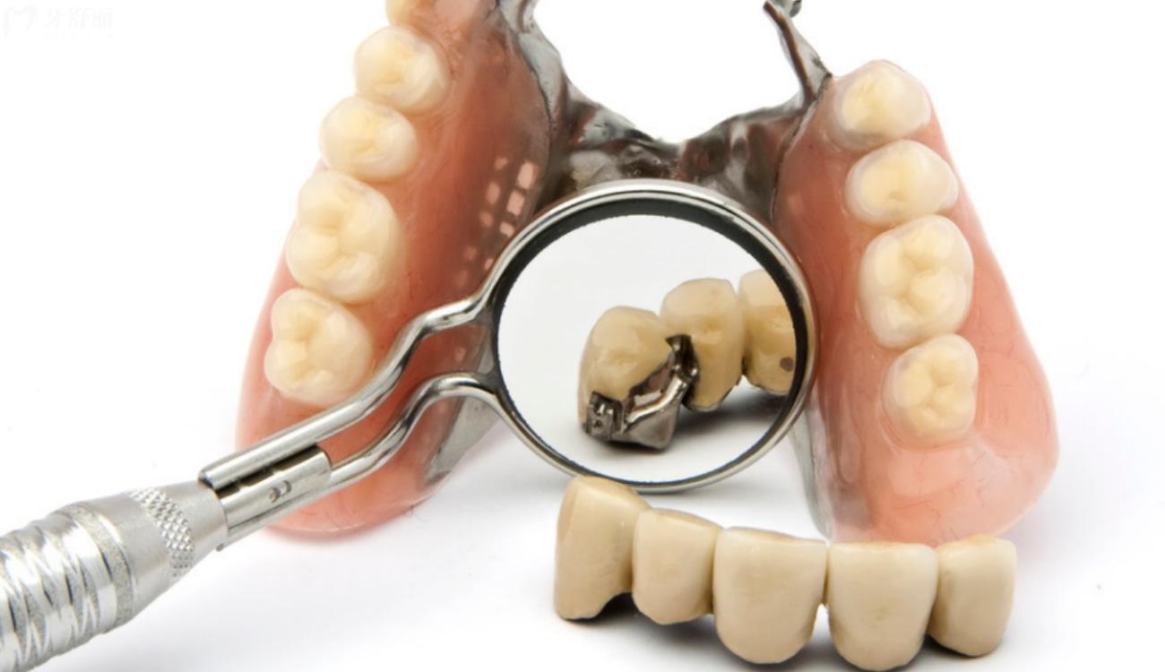 全口假牙价目表.jpg 全口假牙价目表.jpg