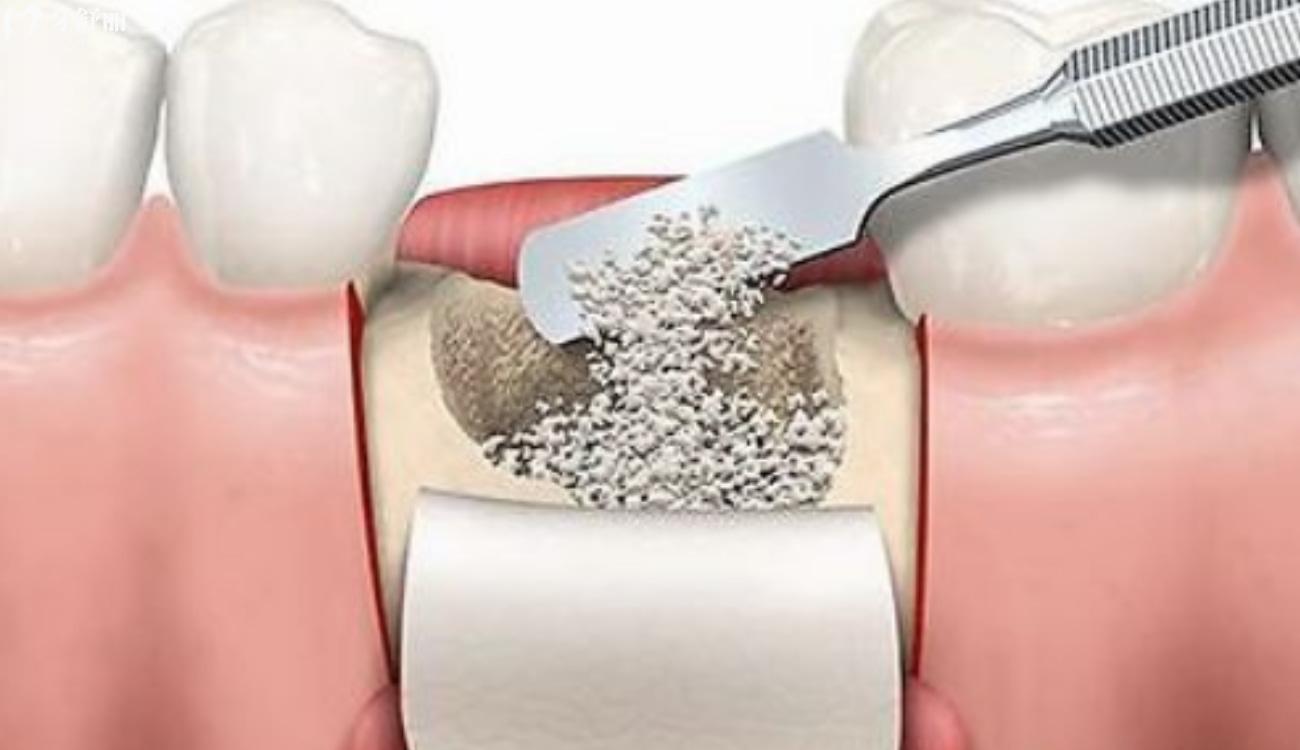 全口假牙价目表.jpg 全口假牙价目表.jpg