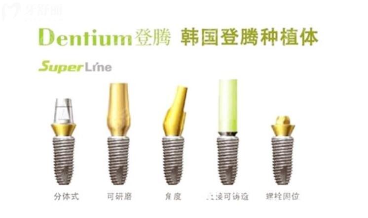韩国种植牙登腾和奥齿泰哪个好 韩国种植牙登腾和奥齿泰哪个好