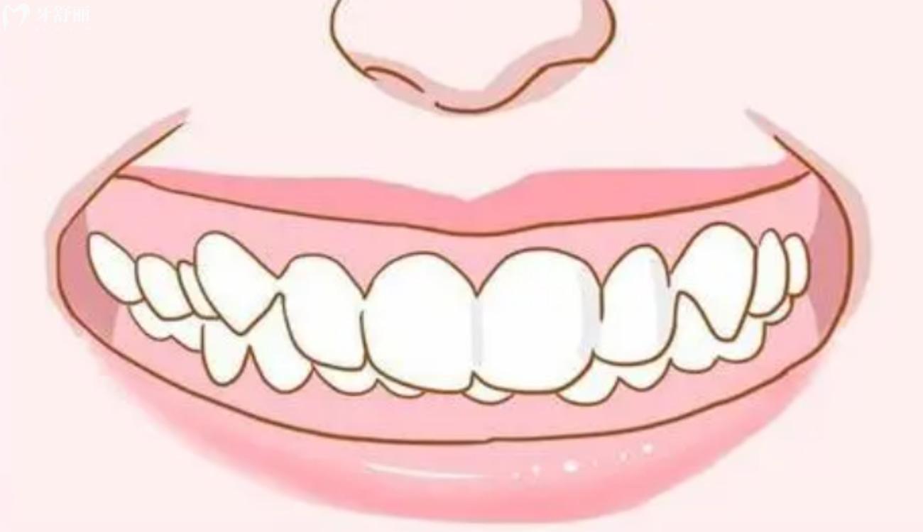 平常牙齿是合的还是不合的？.jpg