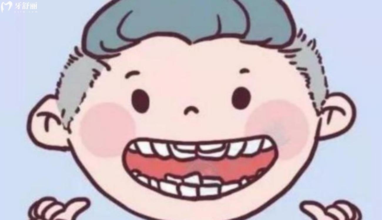 儿童双排牙要立刻拔吗.jpg 儿童双排牙要立刻拔吗.jpg