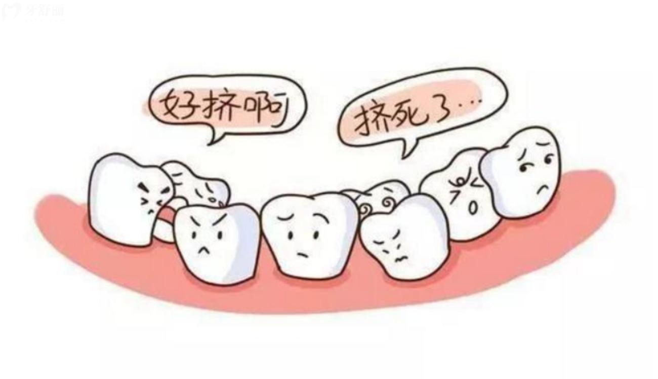 儿童双排牙要立刻拔吗.jpg 儿童双排牙要立刻拔吗.jpg