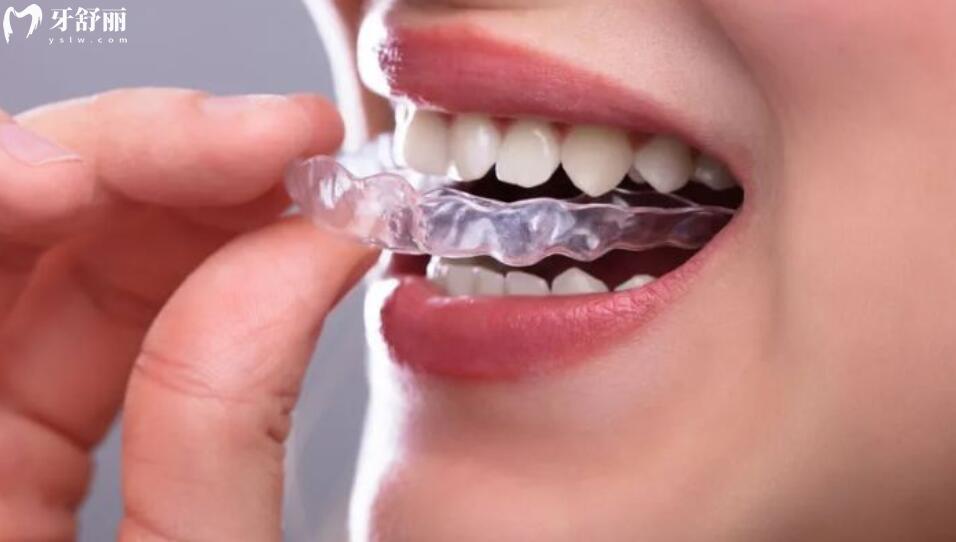 隐形牙齿矫正需要多少钱 隐形牙齿矫正需要多少钱
