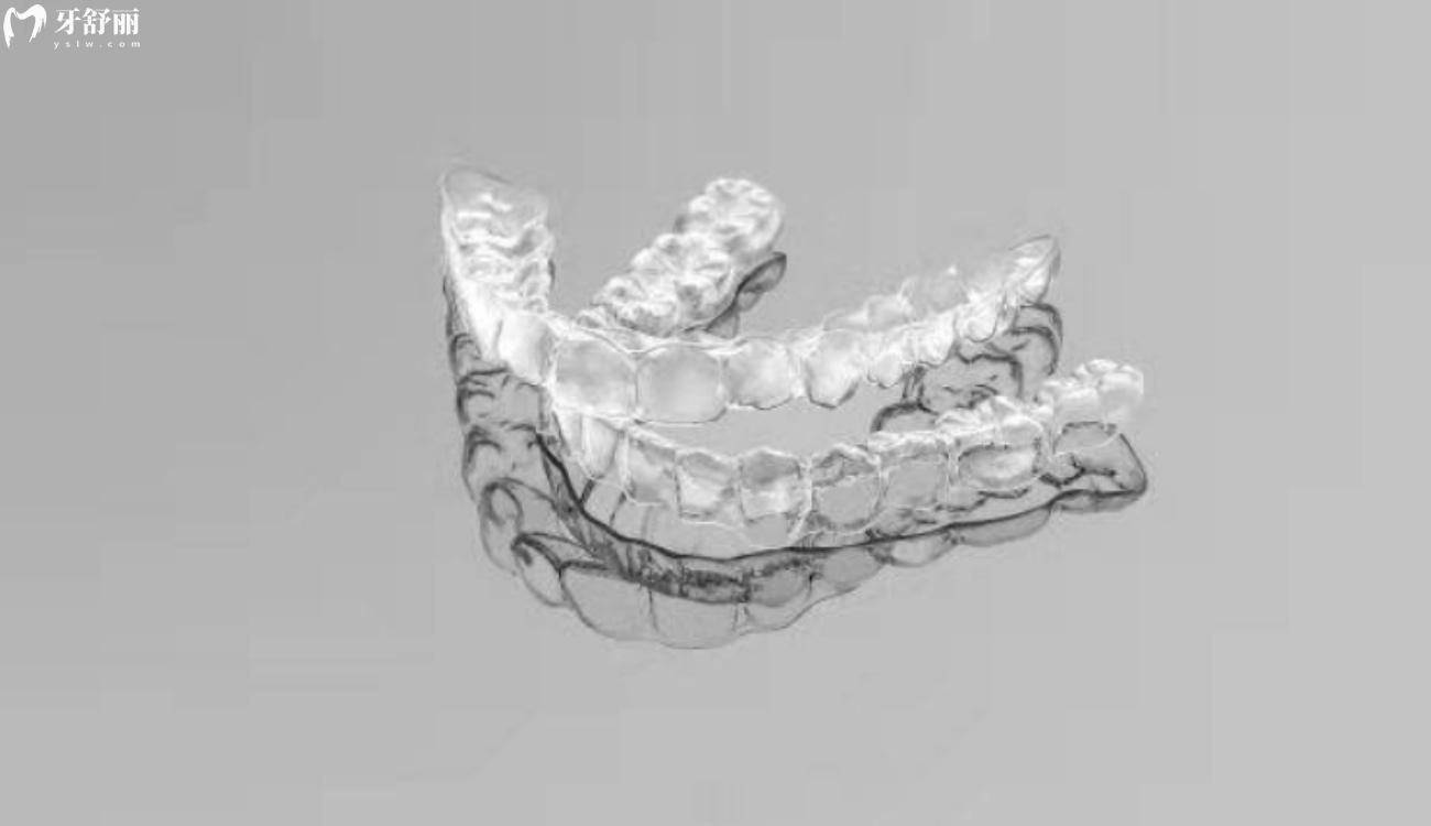 深覆合矫正要多少钱.jpg 深覆合矫正要多少钱.jpg