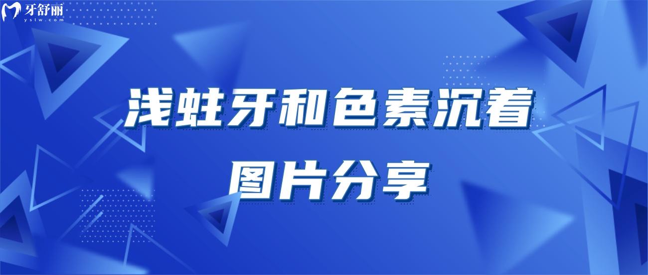 浅蛀牙和色素沉着图片.jpg 浅蛀牙和色素沉着图片.jpg