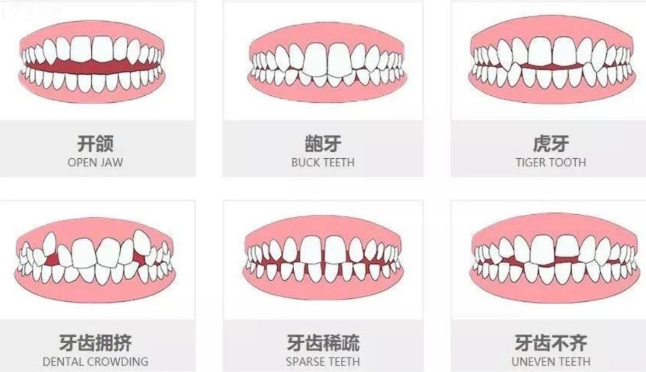 矫正牙齿去医院好还是口腔诊所好.jpg 矫正牙齿去医院好还是口腔诊所好.jpg