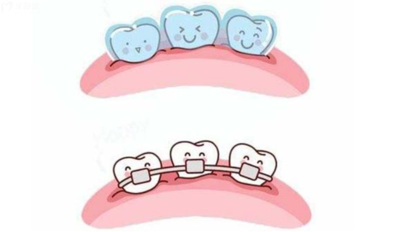 矫正牙齿去医院好还是口腔诊所好.jpg 矫正牙齿去医院好还是口腔诊所好.jpg