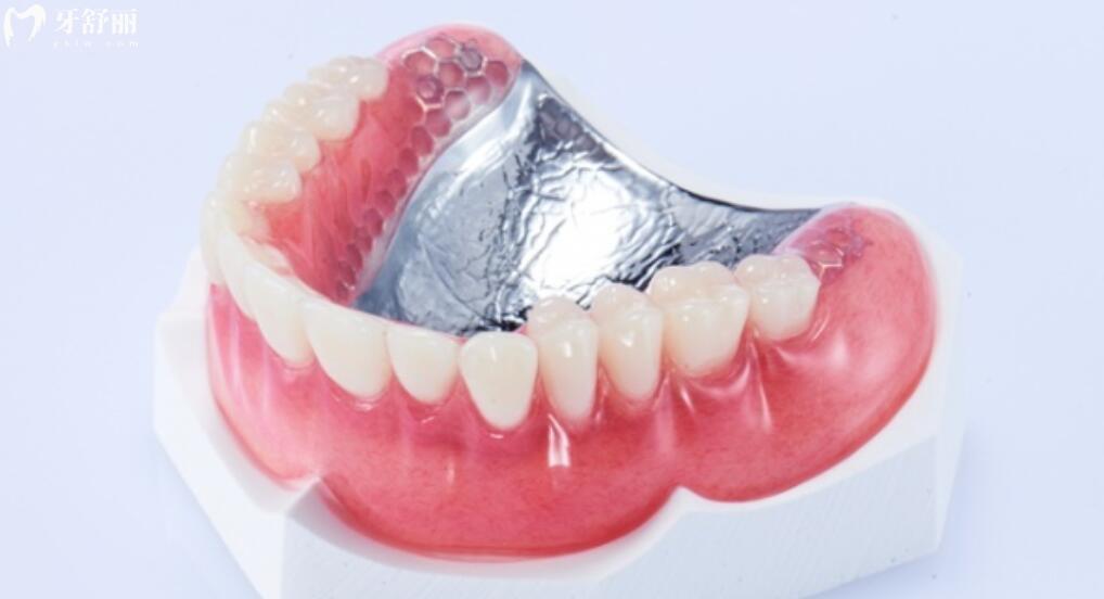 吸附性义齿可以只做半口吗 吸附性义齿可以只做半口吗