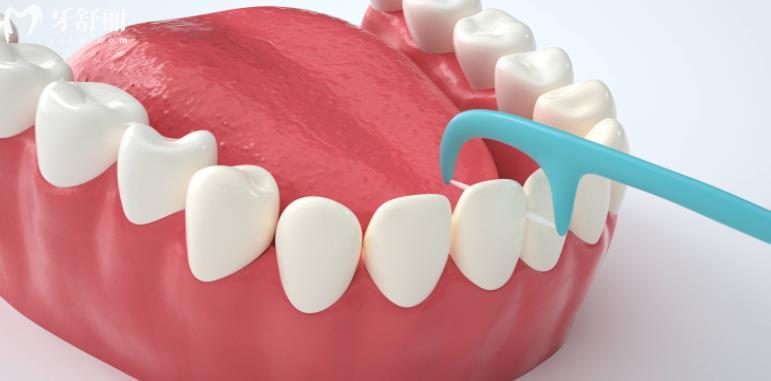 牙龈萎缩不可逆 日常生活中如何保护脆弱的牙龈