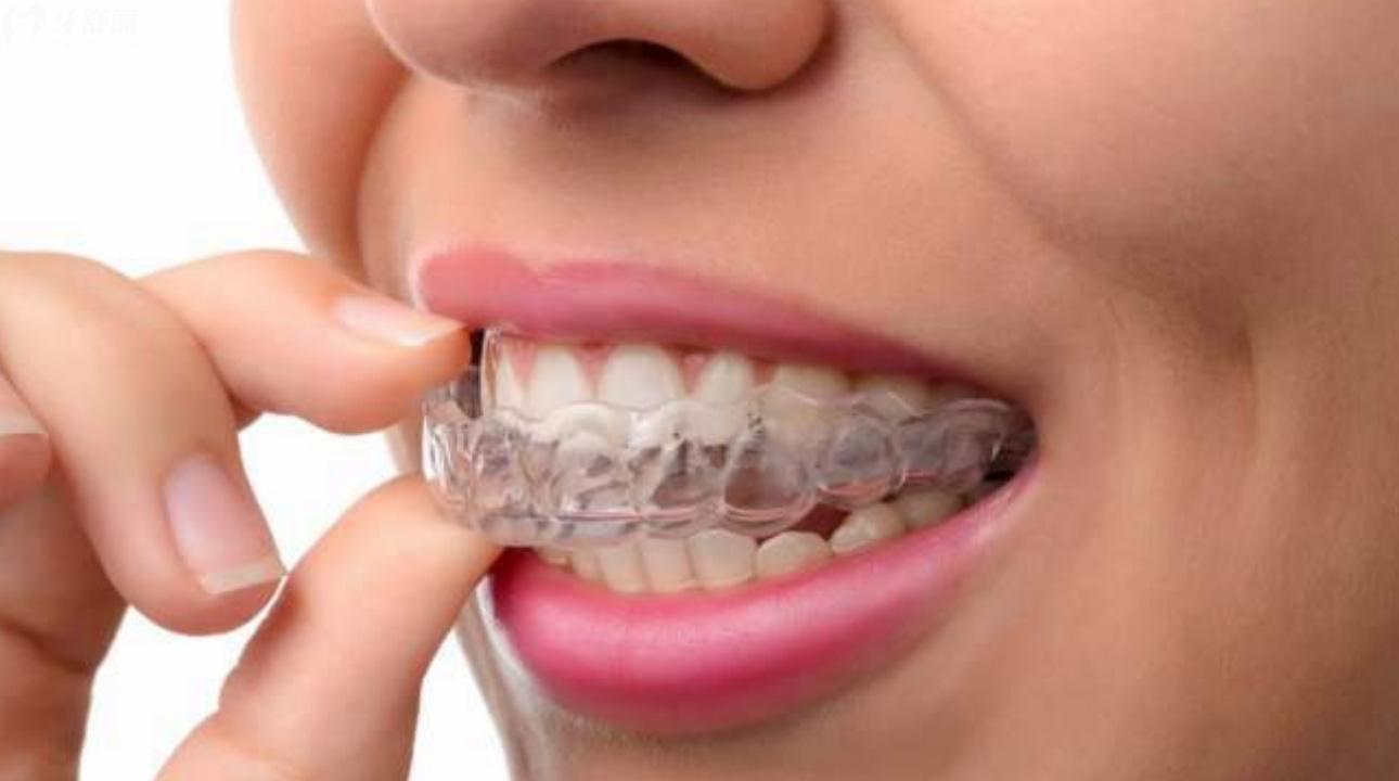 正雅悦享版和经典版哪个贵?一览价格/适应人群/优缺点 正雅悦享版和经典版哪个贵?一览价格/适应人群/优缺点