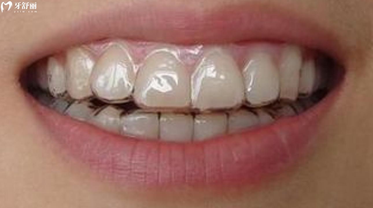 正雅悦享版和经典版哪个贵?一览价格/适应人群/优缺点 正雅悦享版和经典版哪个贵?一览价格/适应人群/优缺点