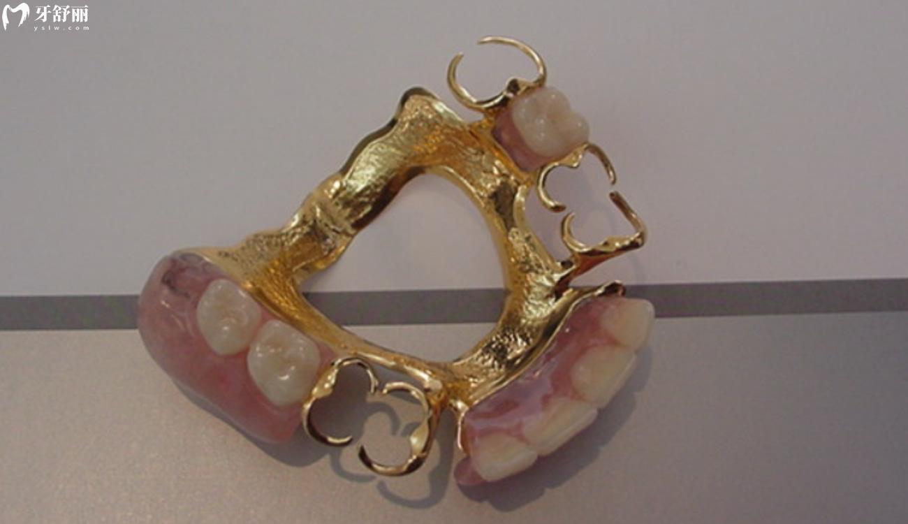 30多岁全口假牙还能活吗.jpg 30多岁全口假牙还能活吗.jpg