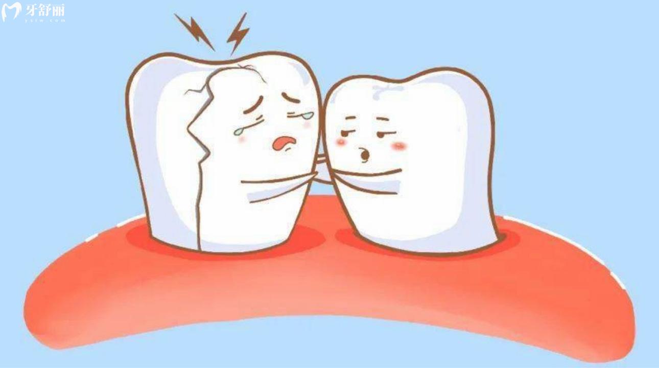 牙隐裂不治疗能坚持多久?牙隐裂疼痛为什么医生不治疗?