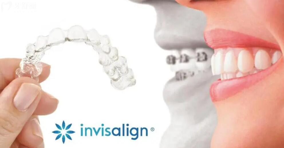 隐适美隐形矫正适合青少年吗 隐适美隐形矫正适合青少年吗