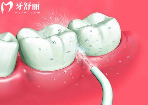 金华牙科医院各牙科项目价格
