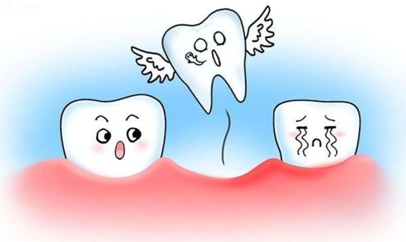 牙掉了多长时间可以种植牙？种植牙齿后需要特别注意什么吗