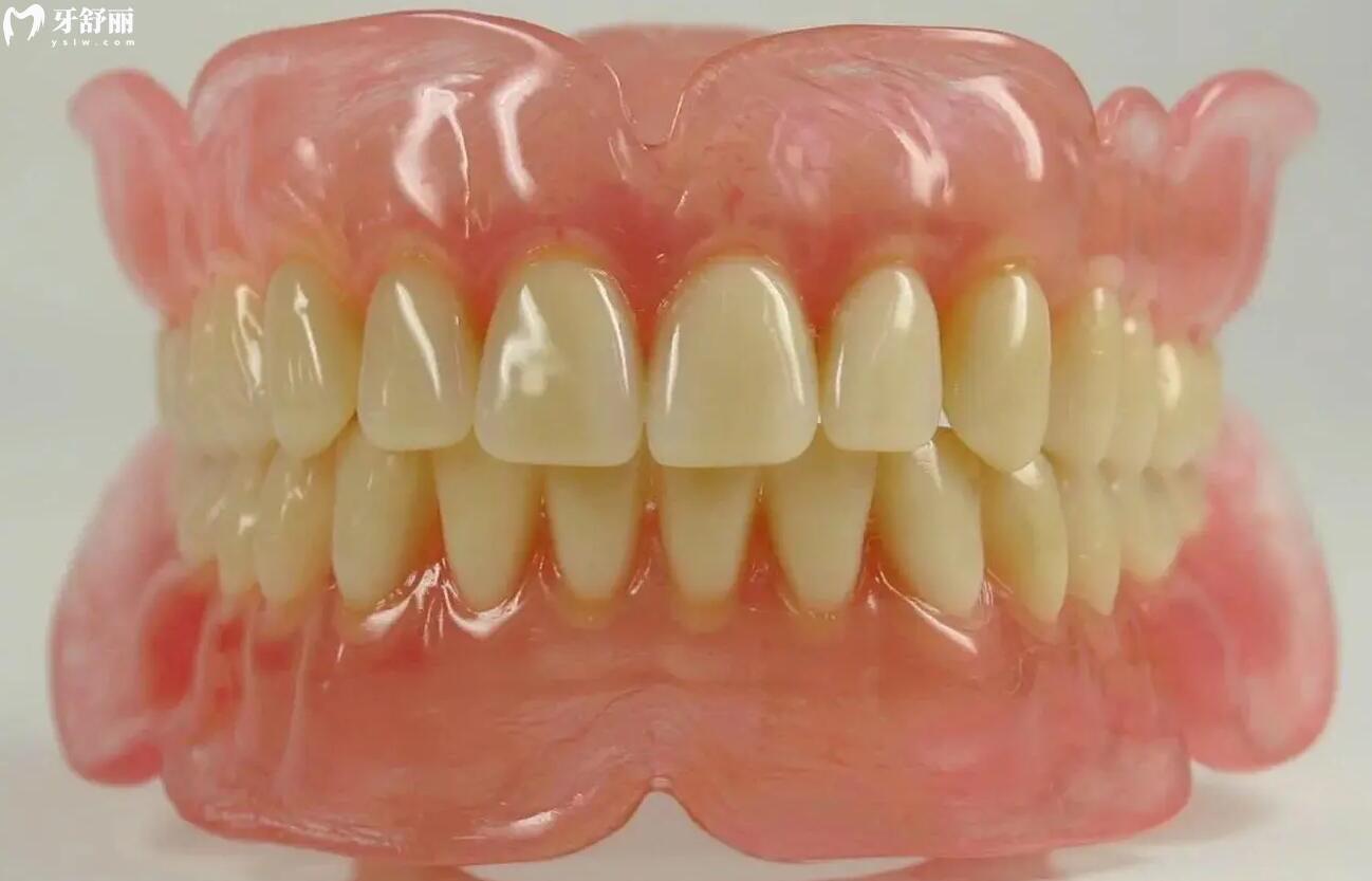 掉了一颗牙是种植好还是镶牙好呢?优缺点对比后让我不再犹豫 掉了一颗牙是种植好还是镶牙好呢?优缺点对比后让我不再犹豫