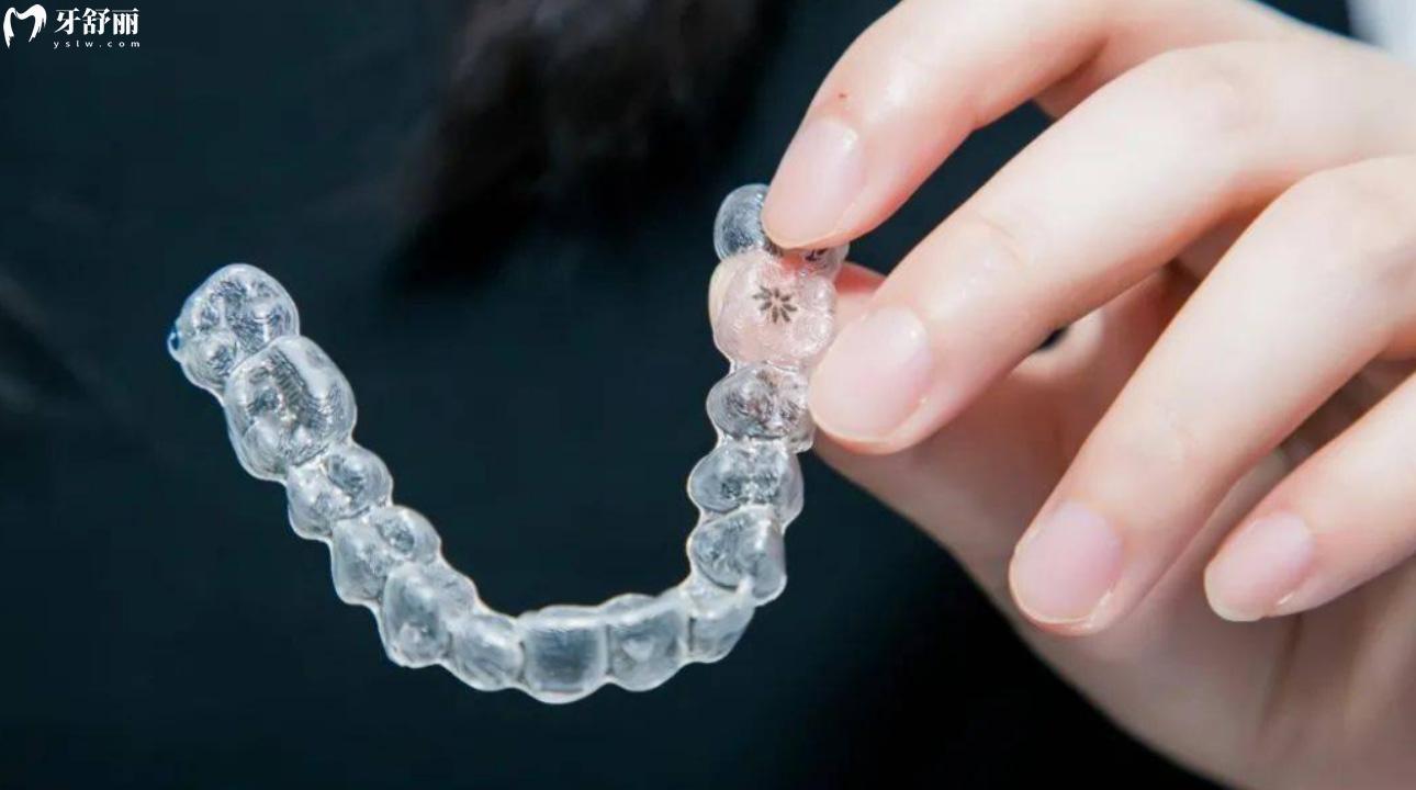 隐适美多久能看到反响?优缺点/价格是什么? 隐适美多久能看到反响?优缺点/价格是什么?