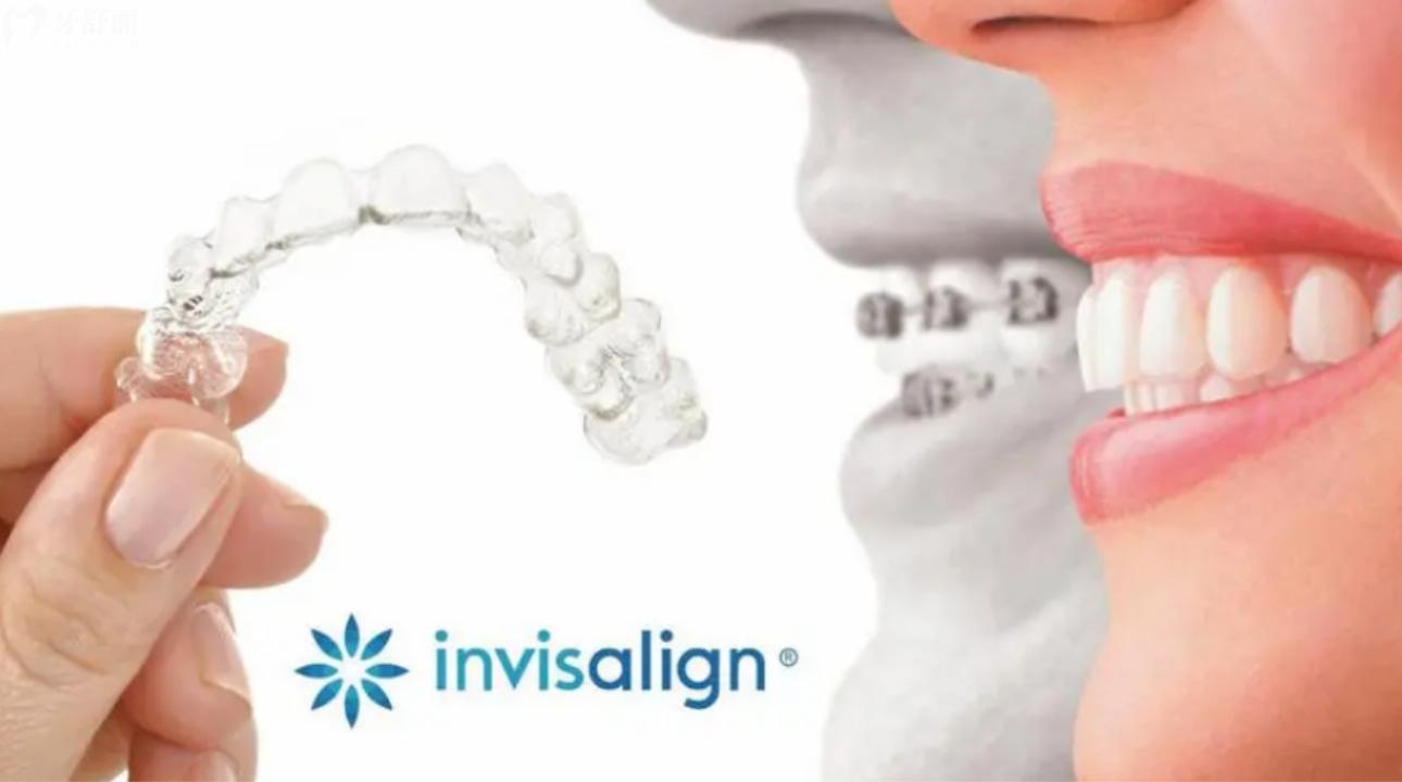 隐适美多久能看到反响?优缺点/价格是什么? 隐适美多久能看到反响?优缺点/价格是什么?