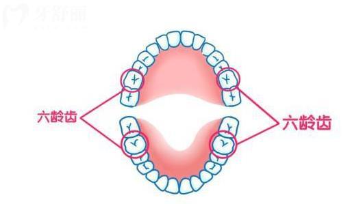 家长们容易忽略的六龄齿,小心变成<span style= 家长们容易忽略的六龄齿,小心变成<span style=