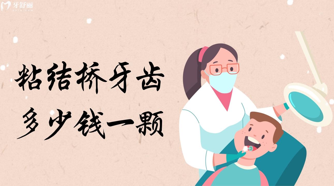 粘结桥牙齿多少钱一颗?粘结桥牙齿优缺点? 粘结桥牙齿多少钱一颗?粘结桥牙齿优缺点?