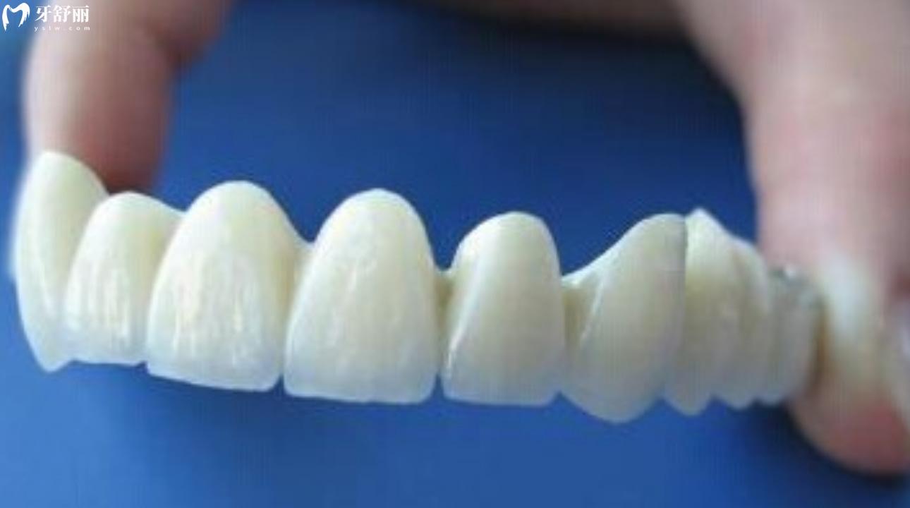 做了没几年的烤瓷牙突然很疼怎么办 烤瓷牙怎么安装上去的 做了没几年的烤瓷牙突然很疼怎么办 烤瓷牙怎么安装上去的
