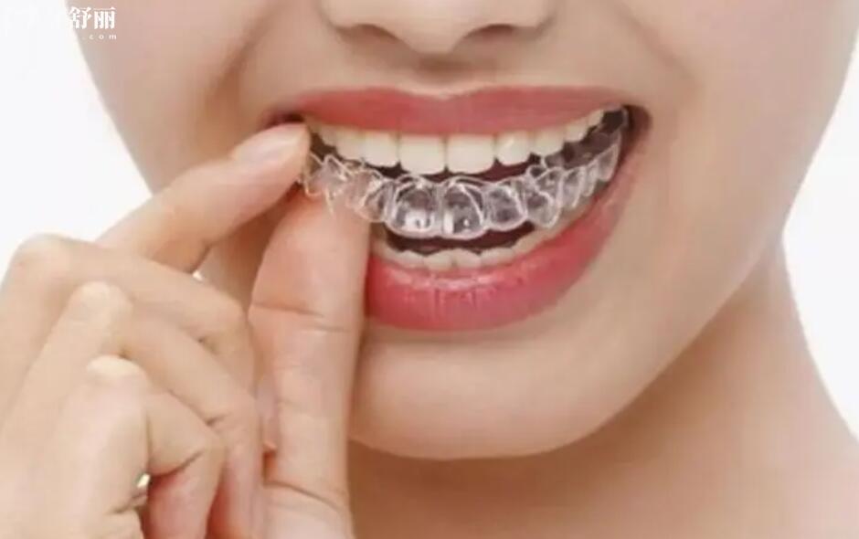 做牙齿矫正需要拔牙吗 做牙齿矫正需要拔牙吗