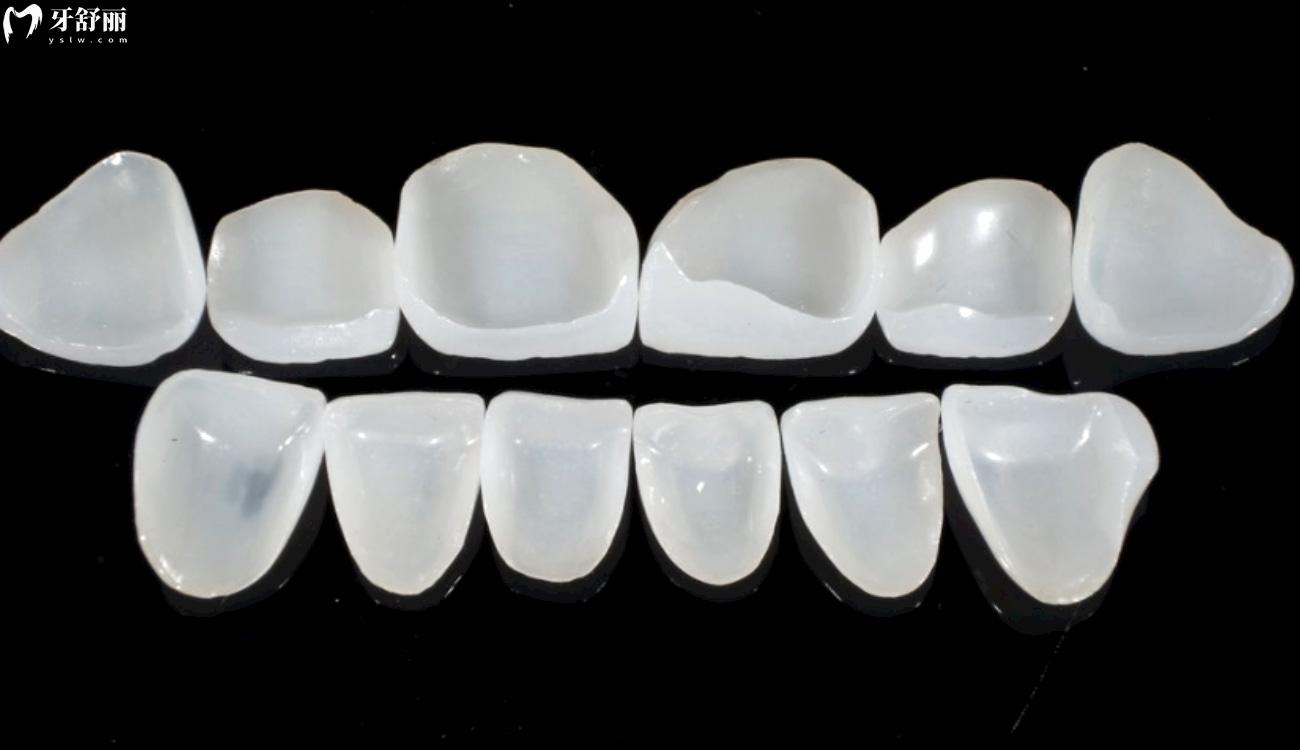 牙齿贴面取下来牙就废了吗.jpg 牙齿贴面取下来牙就废了吗.jpg