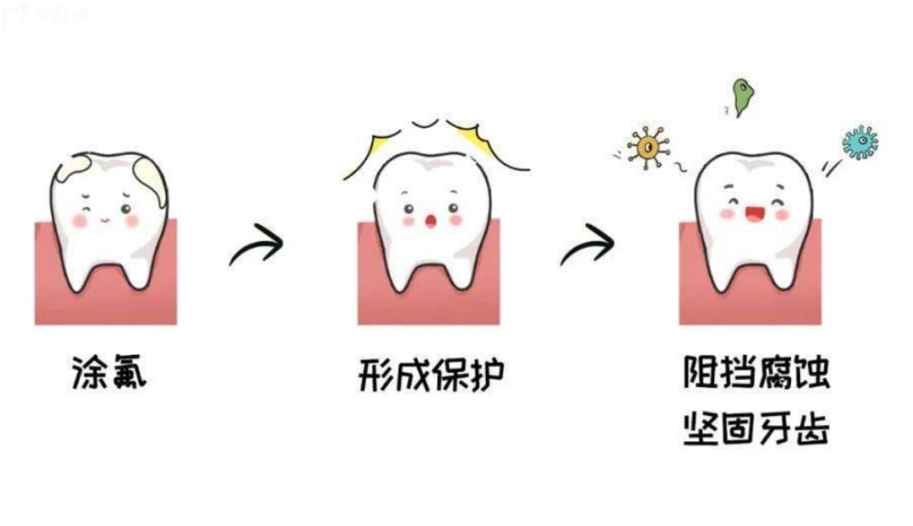 小孩的牙齿涂氟注意事项.jpg 小孩的牙齿涂氟注意事项.jpg