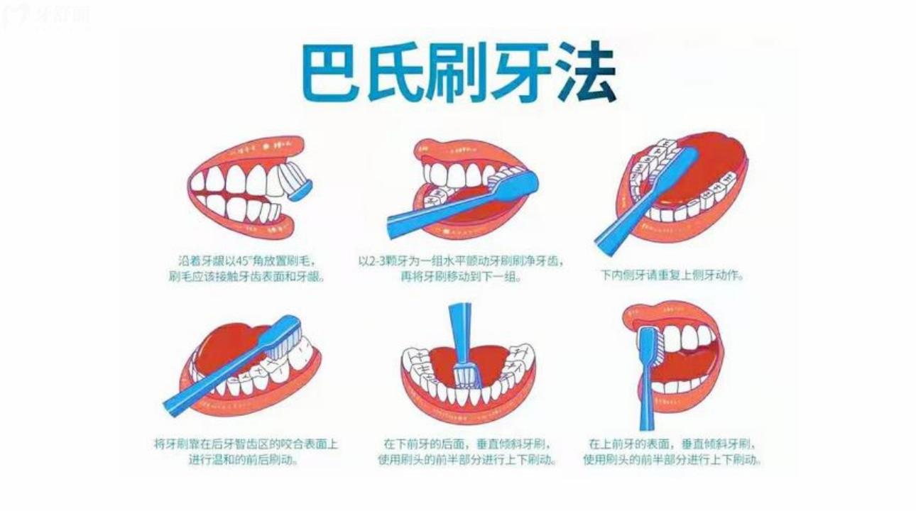 巴氏刷牙法操作流程 巴氏刷牙法真的好吗? 巴氏刷牙法操作流程 巴氏刷牙法真的好吗?
