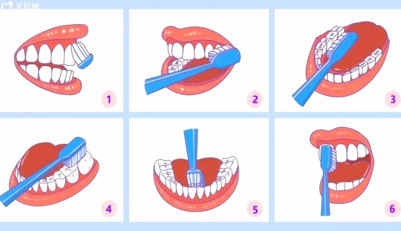5岁蛀牙洞千万不能补是真的吗.jpg 5岁蛀牙洞千万不能补是真的吗.jpg
