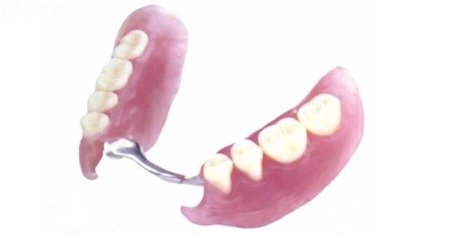 种植牙和镶牙哪个好 种植牙和镶牙哪个好