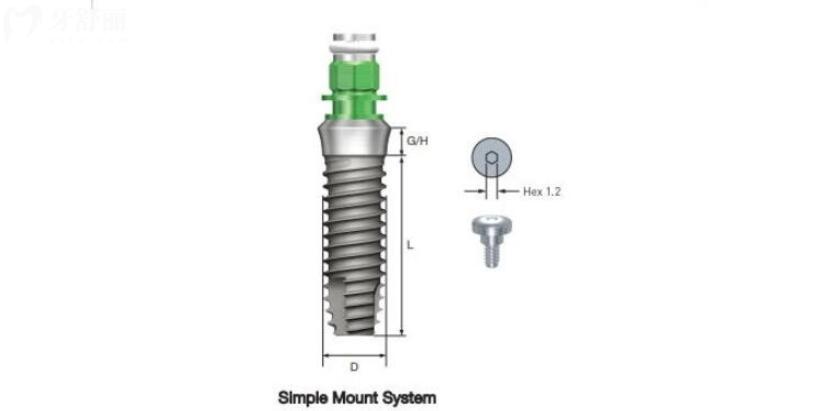 美国种植牙品牌及收费价格表 美国种植牙品牌及收费价格表