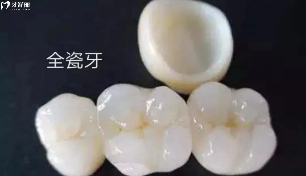 全瓷牙.jpg 全瓷牙.jpg