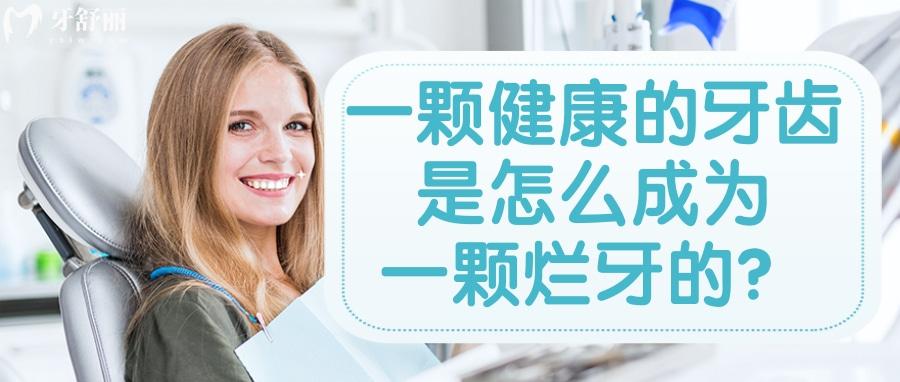 一颗健康的牙齿是怎么发展成为一颗烂牙的?其实只有简单几步 一颗健康的牙齿是怎么发展成为一颗烂牙的?其实只有简单几步