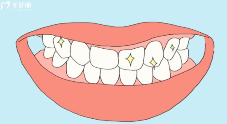 日常牙齿要怎么护理 日常牙齿要怎么护理