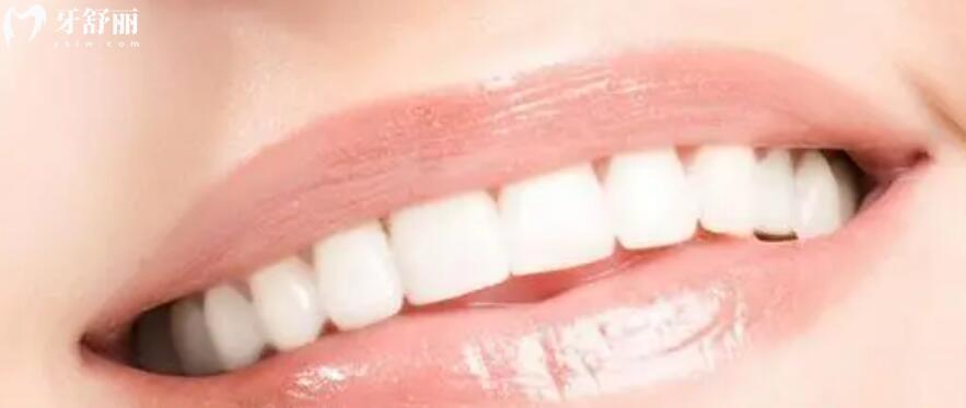 日常牙齿要怎么护理 日常牙齿要怎么护理