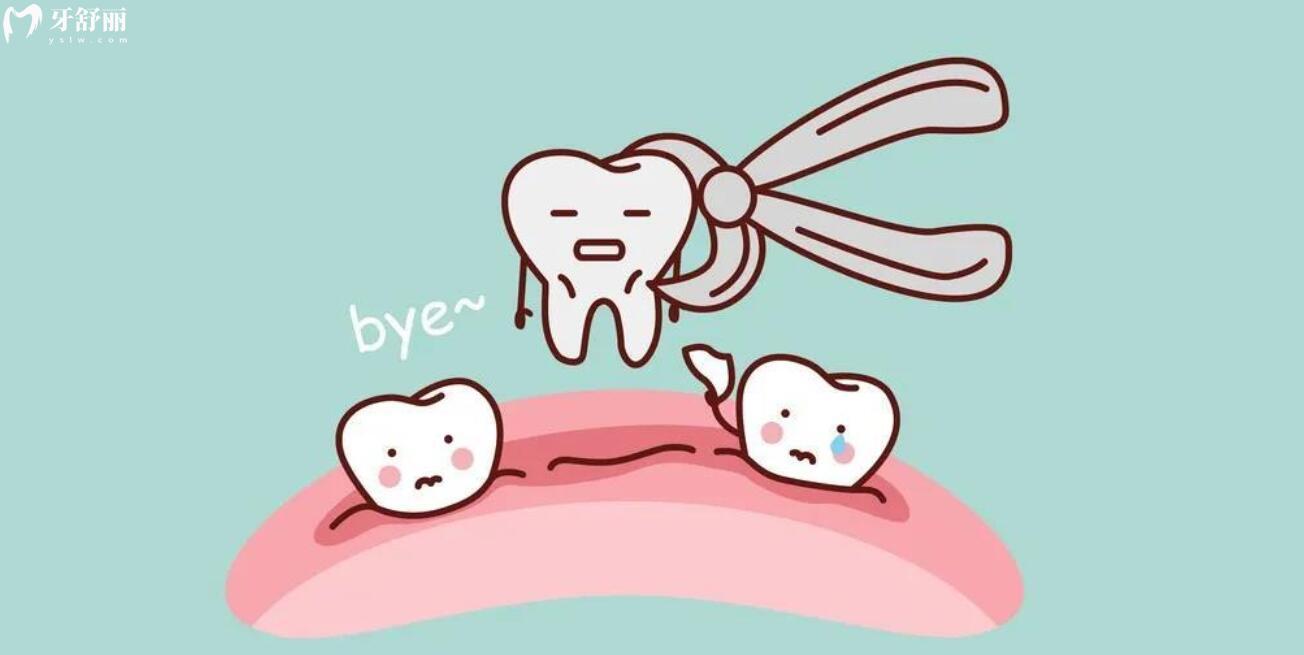 拔智齿期要多久再拔另一侧牙齿好?智齿拔出后需要注意什么 拔智齿期要多久再拔另一侧牙齿好?智齿拔出后需要注意什么