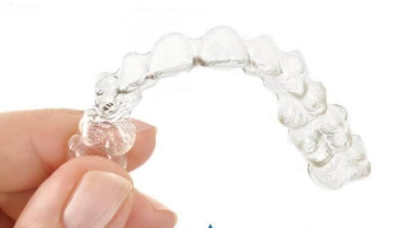 12岁儿童牙齿矫正费用多少钱.jpg 12岁儿童牙齿矫正费用多少钱.jpg