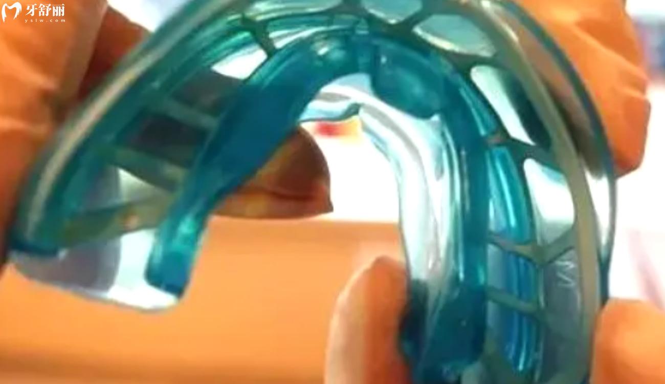 12岁儿童牙齿矫正费用多少钱.jpg 12岁儿童牙齿矫正费用多少钱.jpg