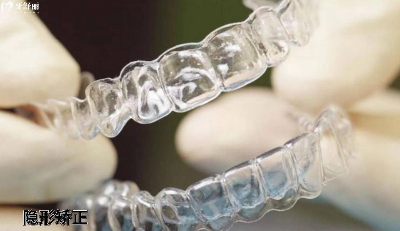自己网上买的牙套矫正成功了是真的吗.jpg 自己网上买的牙套矫正成功了是真的吗.jpg