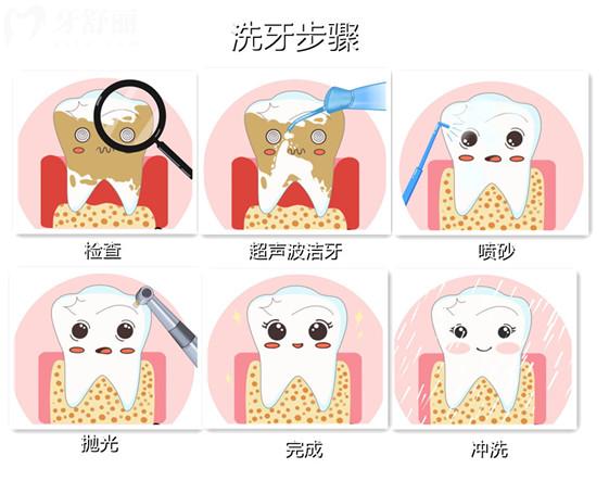 为什么洗牙会难受,洗牙的完整过程是怎么样的? 为什么洗牙会难受,洗牙的完整过程是怎么样的?