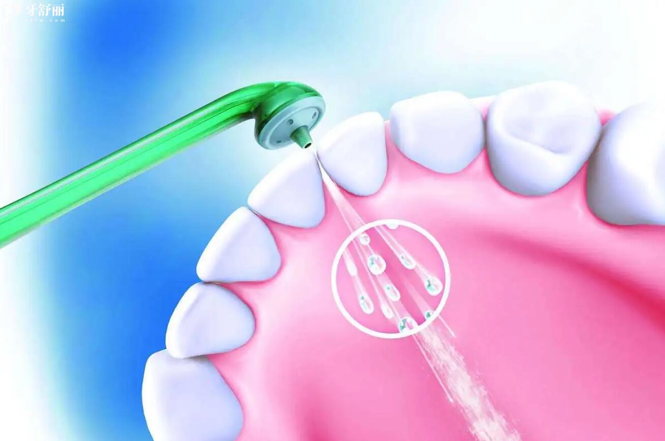 洗牙对牙齿有什么好处和坏处?多长时间洗一次比较好 洗牙对牙齿有什么好处和坏处?多长时间洗一次比较好