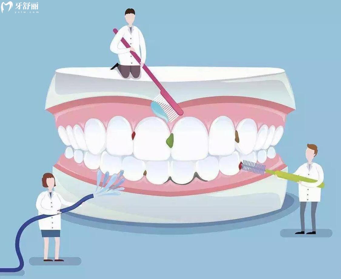 洗牙对牙齿有什么好处和坏处?多长时间洗一次比较好 洗牙对牙齿有什么好处和坏处?多长时间洗一次比较好