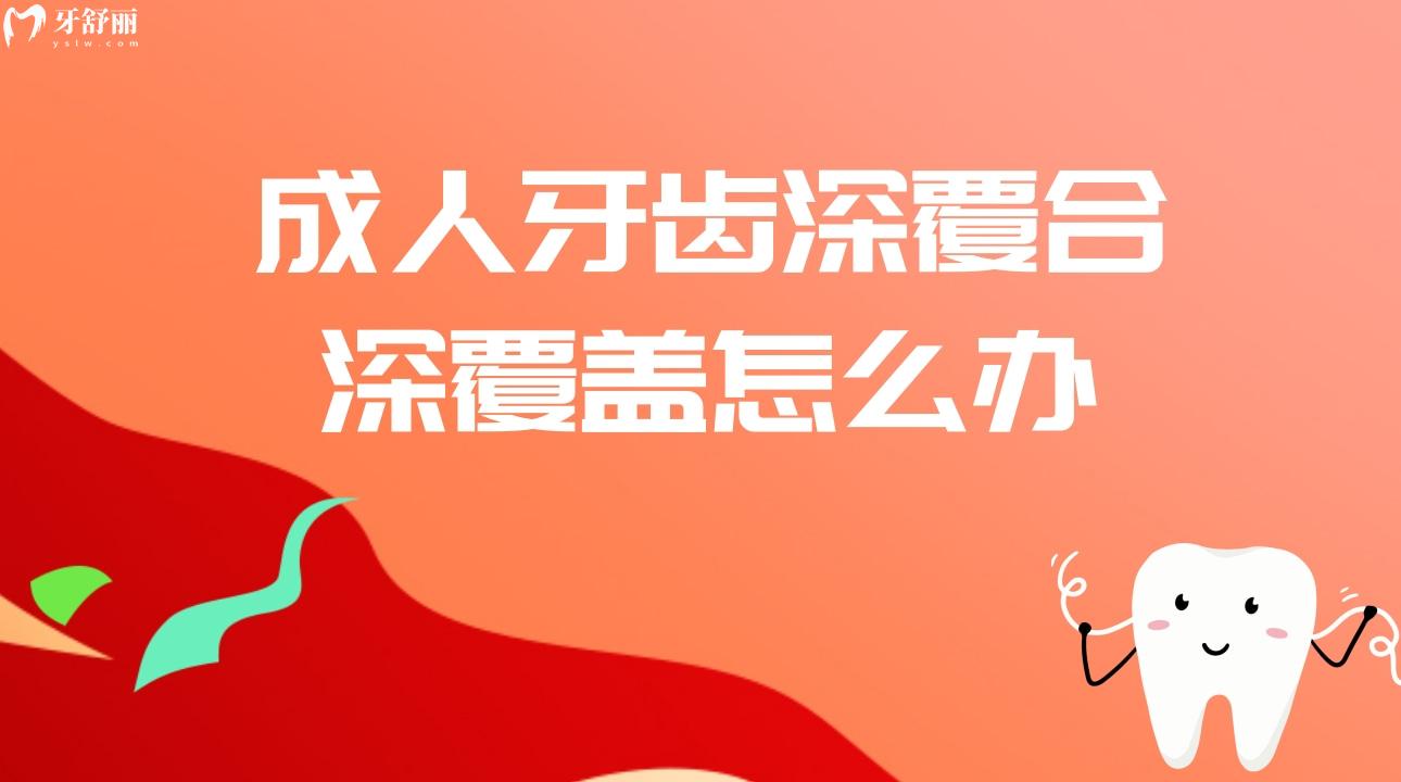 成人牙齿深覆合深覆盖怎么办 什么是深覆合深覆盖? 成人牙齿深覆合深覆盖怎么办 什么是深覆合深覆盖?