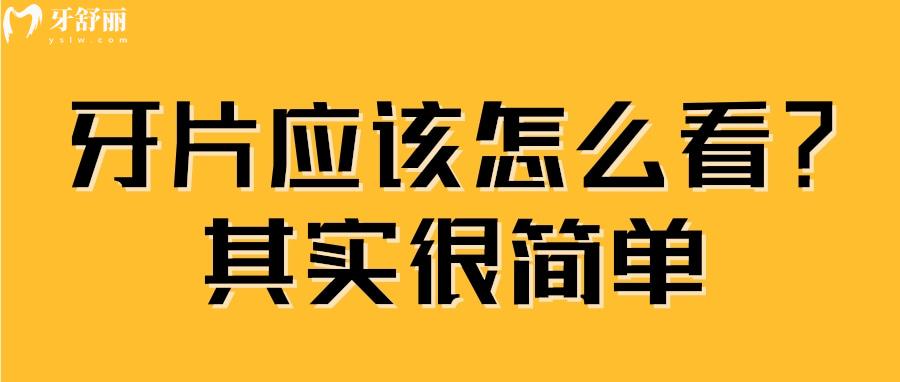 牙科拍的牙片怎么看?叫你简单几步看牙片不被坑 牙科拍的牙片怎么看?叫你简单几步看牙片不被坑