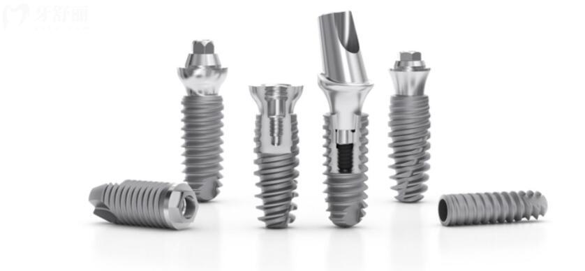 法国安卓健种植牙是什么档次 法国安卓健种植牙是什么档次