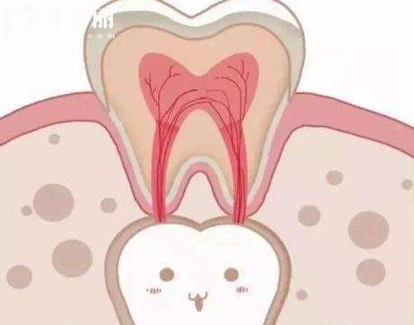 揭秘伴随人一生牙齿的生长过程是怎么样的? 揭秘伴随人一生牙齿的生长过程是怎么样的?