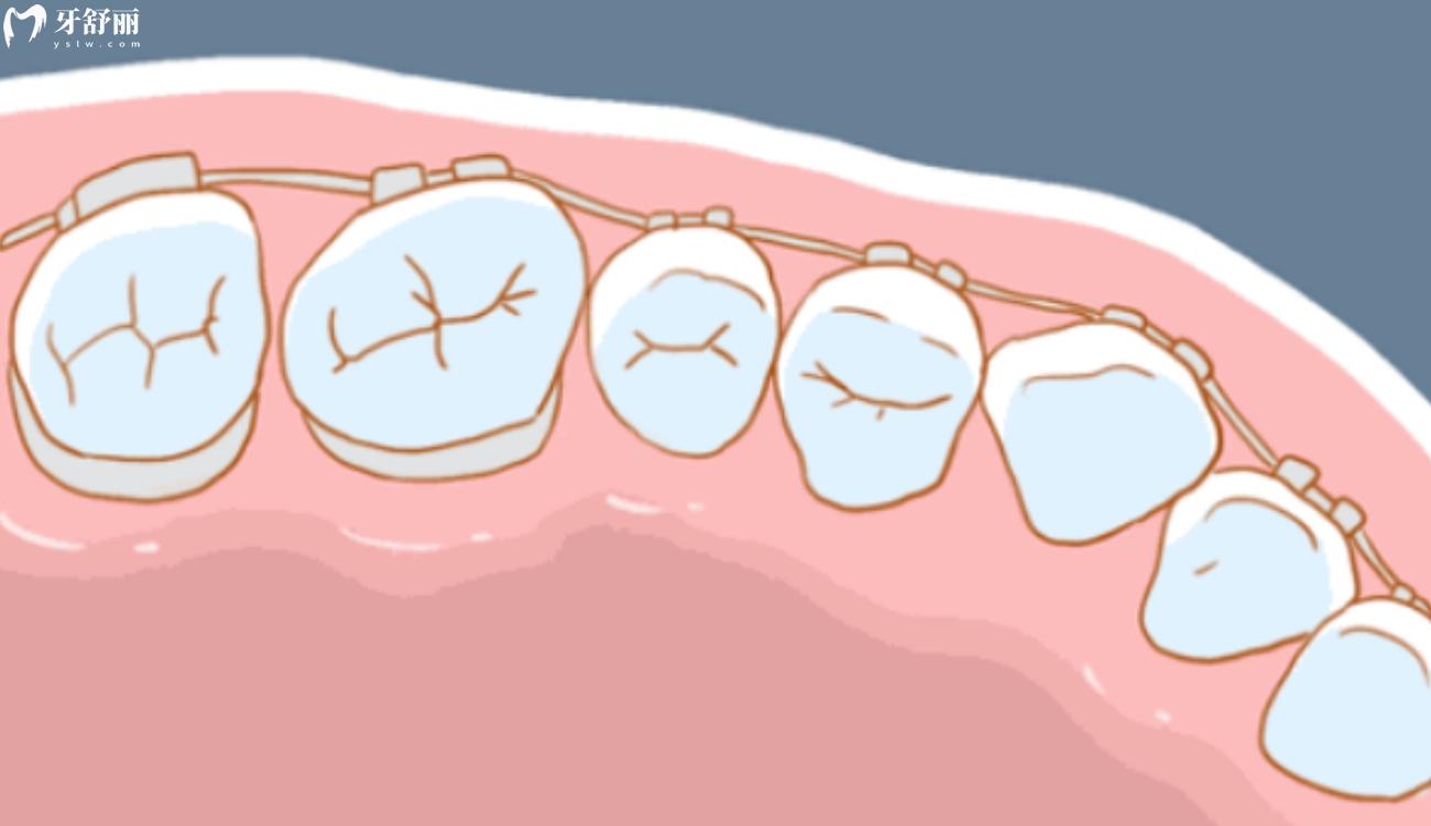 正畸牙齿后遗症太可怕了.jpg 正畸牙齿后遗症太可怕了.jpg