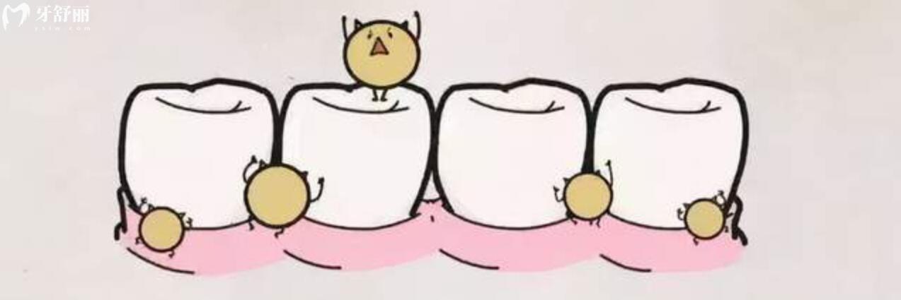 牙龈有点发黑也不疼是怎么回事?应该怎么解决呢 牙龈有点发黑也不疼是怎么回事?应该怎么解决呢